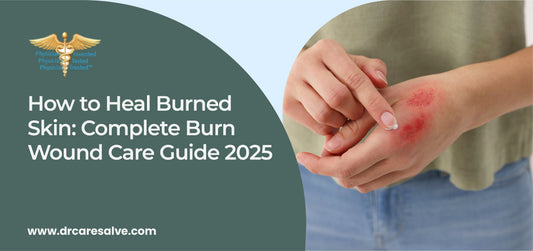 How to Heal Burned Skin: Complete Burn Wound Care Guide 2025